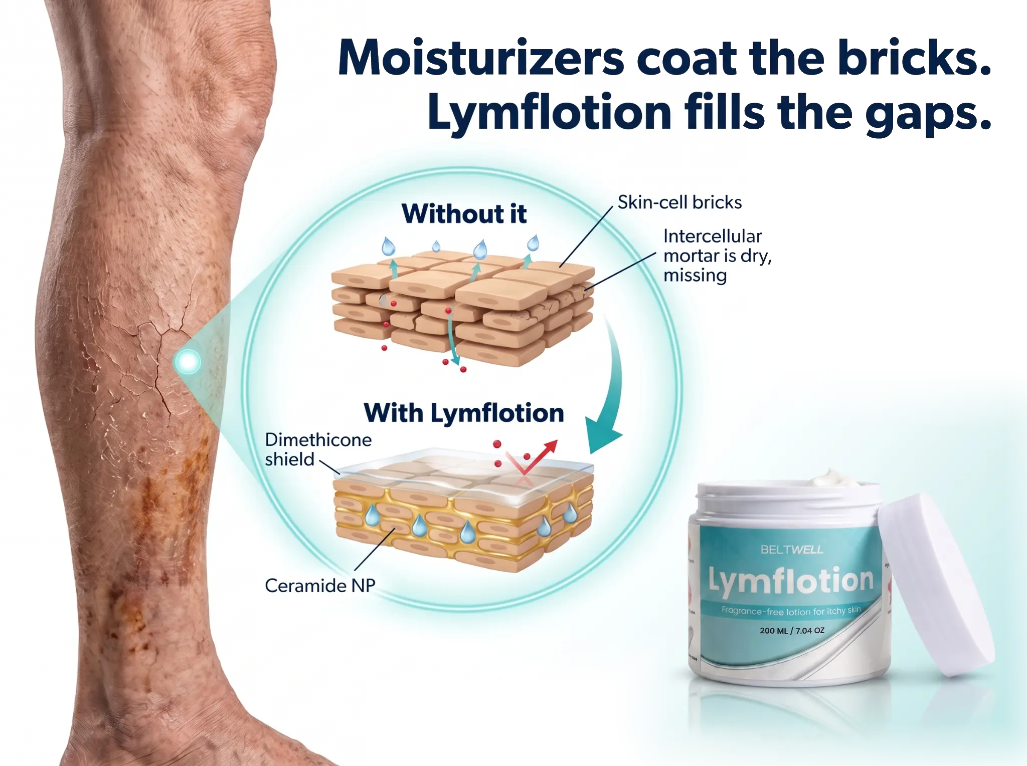 Skin barrier illustration showing a dry, cracked leg, skin-cell gaps, a hydrated barrier, and LymfLotion